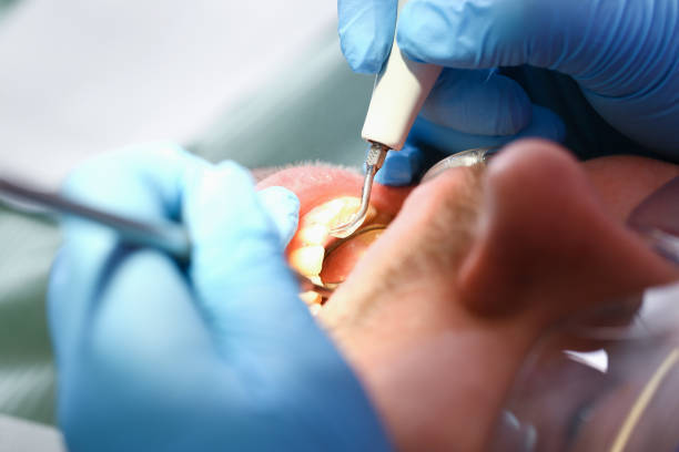 Best Pediatric Emergency Dentist in Hampton, TN
