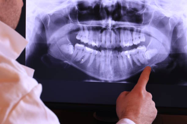 Best Emergency Root Canal Treatment in Hampton, TN