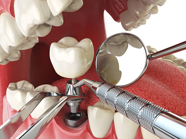 Best Emergency Dentist for Special Needs Patients in Hampton, TN