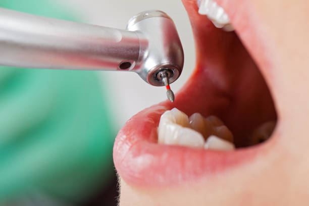 Best Urgent Dental Care for Toothache in Hampton, TN